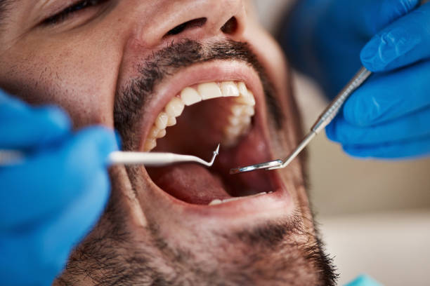 Best Walk-In Emergency Dentist in Dubuque, IA