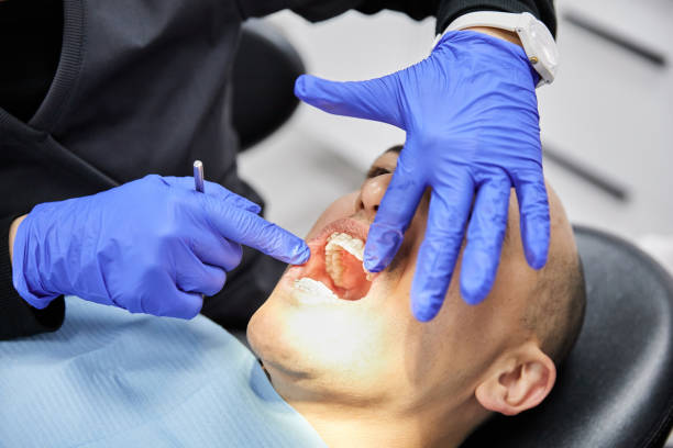 Best Emergency Treatment for Toothache in Dubuque, IA