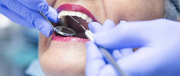 Best Emergency Root Canal Treatment in Dubuque, IA